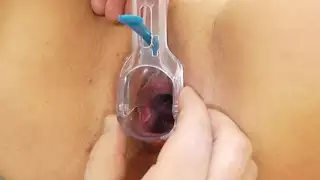 حجم البطيخ الطبيعية الضخمة في obgyn وثيقة