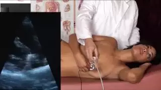 نبضات بطيئة