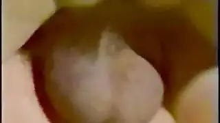 الداعر الشرج والوجه الكلاسيكية