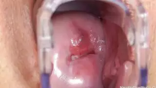 أندولا هي الممرضة العملية الأكثر شذوذاً