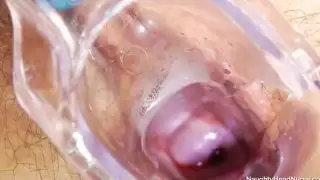 لادا يلهون بالإضافة إلى الديك اللاتكس في الزي الرسمي