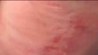 عبدي معلقة رأسا على عقب ويصدم!