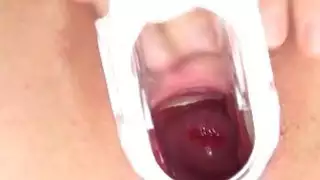 المتطرفة التشيكية fairhair كس محدق
