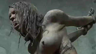 حدود villein غال هو الحصول على عقوبة العضو التناسلي النسوي